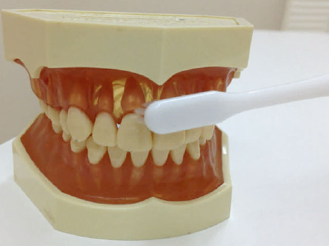 歯と歯ぐきの境目が虫歯になりやすいポイント
